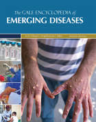 The Gale Encyclopedia of Emerging Diseases, ed. 2, v. 