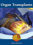 Organ Transplants, ed. , v. 