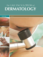 The Gale Encyclopedia of Dermatology, ed. , v. 