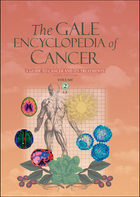 The Gale Encyclopedia of Cancer, ed. 3, v. 