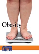 Obesity, ed. , v. 