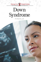 Down Syndrome, ed. , v. 