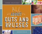 All About Cuts and Bruises, ed. , v. 