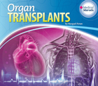 Organ Transplants, ed. , v. 