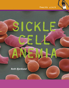 Sickle Cell Anemia, ed. , v. 