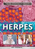 Herpes, ed. , v. 