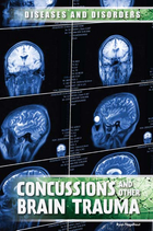 Concussions and Other Brain Trauma, ed. , v. 